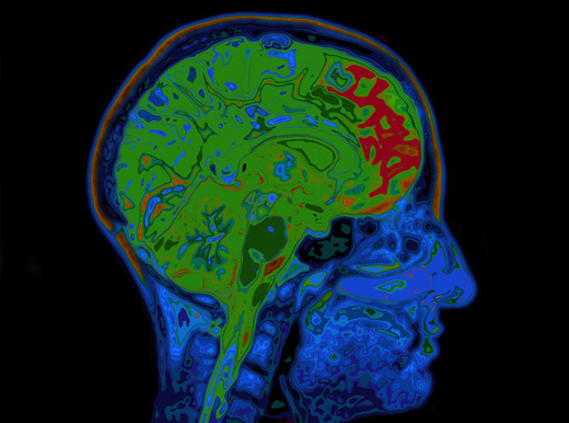 Perché il cervello è a rischio?