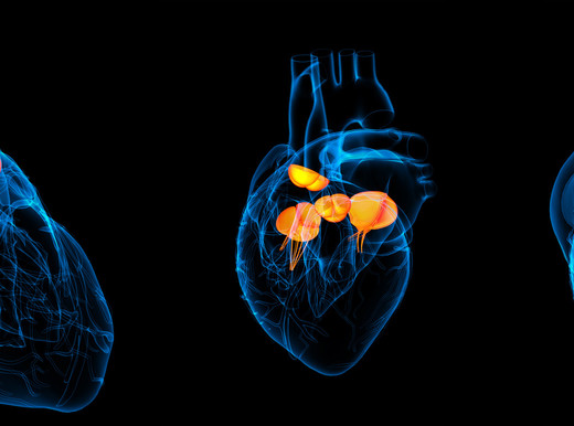 Quanto è grave lo scompenso cardiaco