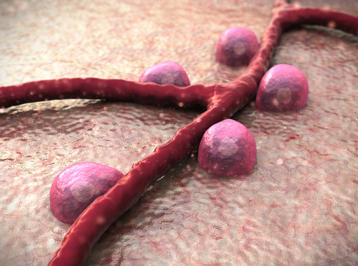 Così il diabete attacca i vasi e il cuore