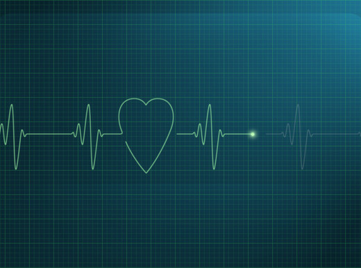 La sindrome di Brugada, quando il cuore impazzisce