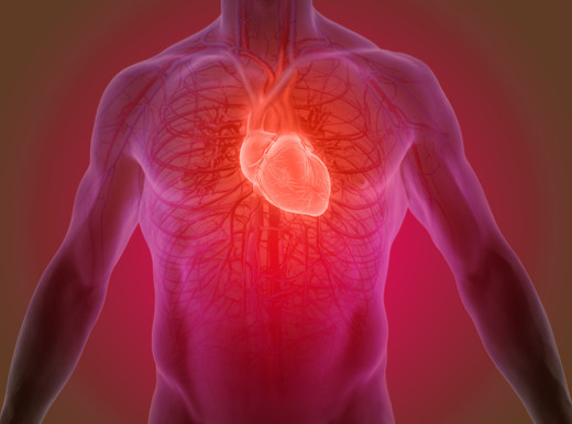 L’infarto del miocardio