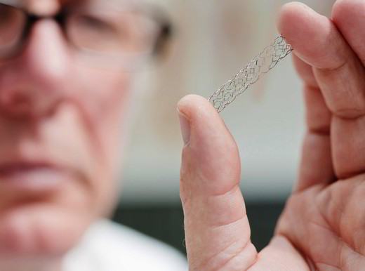 Farmaci dopo lo stent coronarico? La scelta passa (anche) per il Dna