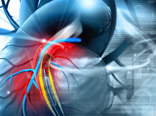 Risultati immagini per arterie coronariche