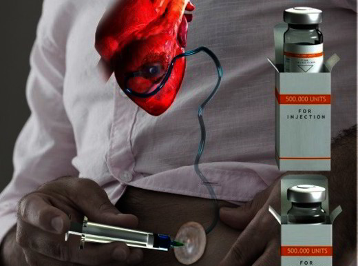 Un "cerotto" a lento rilascio di staminali per proteggere il cuore dopo l’infarto