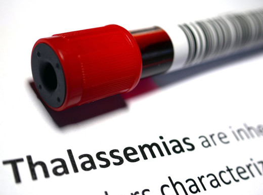 Così si ammala il cuore nella talassemia