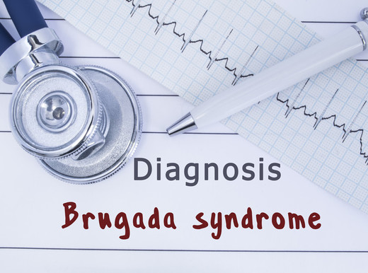 Ecco perché la sindrome di Brugada mette a rischio il cuore