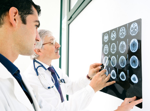 I rapporti “pericolosi” tra ictus e infarto