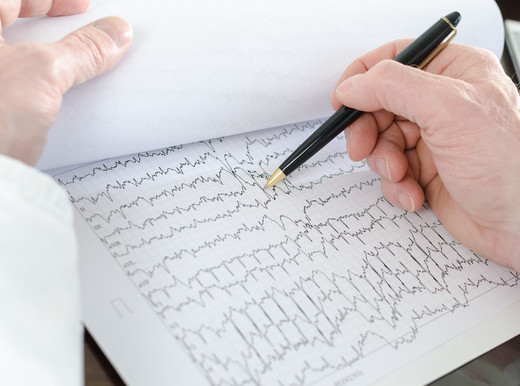 Fibrillazione atriale, ne soffrono più di 700mila italiani. Ecco i nuovi trattamenti
