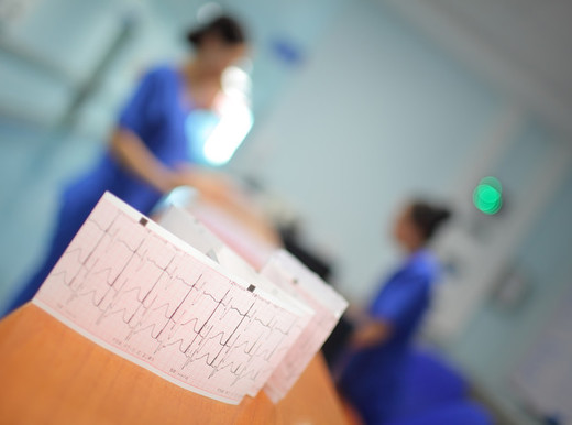 Come prevenire l’ictus in chi soffre di fibrillazione atriale