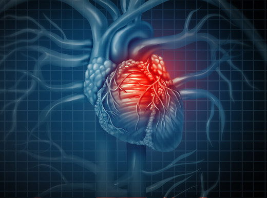 Ricerca italiana a caccia dei segreti della placca che provoca l’infarto