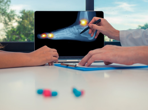 Chi soffre di gotta rischia di più lo scompenso cardiaco