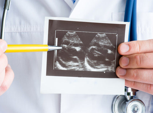 In arrivo nuova cura per rara forma di pericardite infiammatoria