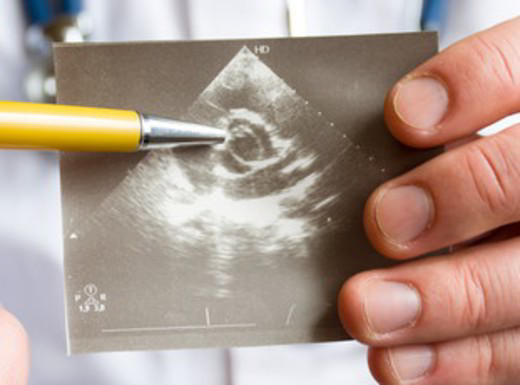 Valvole del cuore, quando si può evitare la chirurgia